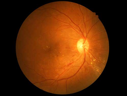 service-retinal-eye.jpg